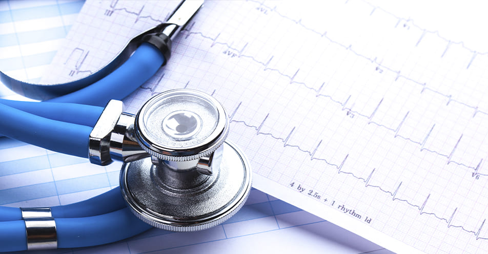 electrocardiograma-cardiologo-certificado-en-cdmx